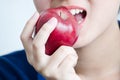 Teeth cut an apple