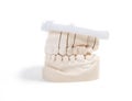 Teeth denture