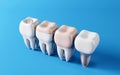 teeth with different types of dental filling with Dental teeth implants, Oral health and dental inspection teeth. Medical dentist