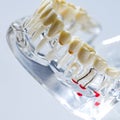 Teeth education model. Shallow dof
