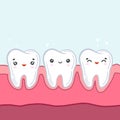 Teeth in the gums. Vector color illustration in cartoon style. Kawaii character. Children`s dentistry