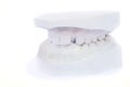 Teeth gypsum model