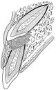 Teeth - Impacted Tooth Cross-section Diagram