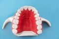 Teeth implant and crown installation process parts isolated on a blue background. Medically accurate 3D model.