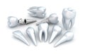 Teeth and implant, Dental concept