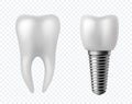 Teeth and implant. Dental surgery human white enamel tooth crown denture orthodontic technology. Artificial teeth