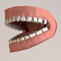 Teeth with lead fillings Royalty Free Stock Photo