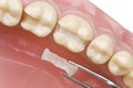 Teeth model