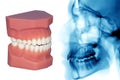 Teeth model and x-ray isolated on withe