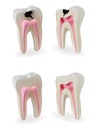 Teeth models Royalty Free Stock Photo