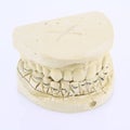 Teeth mold Royalty Free Stock Photo