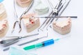 Teeth mold and basic dental tools on white table Royalty Free Stock Photo