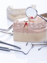 Teeth mold and basic dental tools on white table Royalty Free Stock Photo