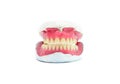 Teeth mold Royalty Free Stock Photo