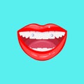 Teeth piercing with diamonds. Female mouth with snow-white teeth. Smile piercing. Decoration of teeth with jewelry