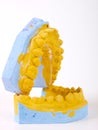 Teeth plaster cast Royalty Free Stock Photo