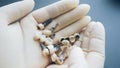 Teeth reconstruction dental ceramic implants hands