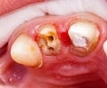 Teeth rehabilitation