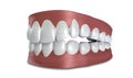 Teeth Set Closed Isolated Royalty Free Stock Photo