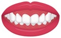 Teeth trouble bite type / crooked teeth vector illustration /Deep bite