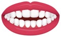 Teeth trouble bite type / crooked teeth vector illustration /Open bite