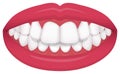 Teeth trouble bite type / crooked teeth vector illustration /Overbite Back teeth