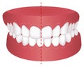 Teeth trouble  bite type  vector illustration / Crossbite misalignment Royalty Free Stock Photo