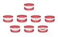 Teeth trouble bite type vector illustration set