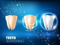 Teeth whitening ad vector realistic illustration