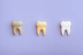 Teeth Whitening Concept Image Changing Colors from Yellow to White