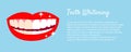 Teeth Whitening concept woth laughed mouse and teeth before and after bleaching. With text places. Good for banners Royalty Free Stock Photo