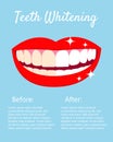 Teeth Whitening concept woth laughed mouse and teeth before and after bleaching. With text places. Good for banners Royalty Free Stock Photo