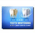 Teeth Whitening Creative Promotional Poster Vector