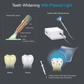 Teeth Whitening With Plasma Light Royalty Free Stock Photo