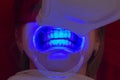 Teeth whitening procedure ultraviolet lamp whiten teeth girl