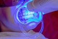 Teeth whitening procedure ultraviolet lamp whiten teeth girl