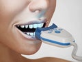 Teeth whitening treatment. 3D illustration