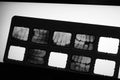 Teeth XRay in Lightbox