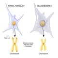 Telomeres  of Chromosome in Normal fibroblast and Cell senescence Royalty Free Stock Photo