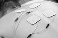 TENS electrodes positioned for back pain treatment in physical t