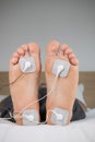 TENS Therapy for heel pain or Plantar Fasciitis, self-administered at home