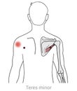 Teres Minor: Managing pain originating from myofascial trigger points in the Teres minor muscle