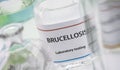 Test brucellosis in laboratory Royalty Free Stock Photo
