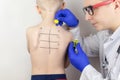 An allergist in the laboratory conducts an allergy prick-test. Skin test for household, food, epidermal allergic reactions. The