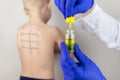 An allergist in the laboratory conducts an allergy prick-test. Skin test for household, food, epidermal allergic reactions. The