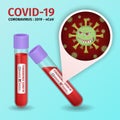 Test tube with positive Coronavirus result. Virus cell with scary and evil face. Laboratory analysis of Coronavirus Royalty Free Stock Photo