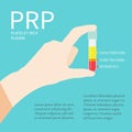 Test tube with PRP