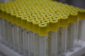 Test tubes for biochemical blood tests are on the table in the laboratory. New test tubes stand in a stand in a medical Royalty Free Stock Photo