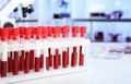 Test tubes with blood samples for analysis on table in laboratory