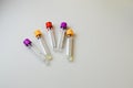Test tubes with blood samples on table in laboratory. Virus research Royalty Free Stock Photo
